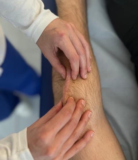 Trattamento delle cicatrici