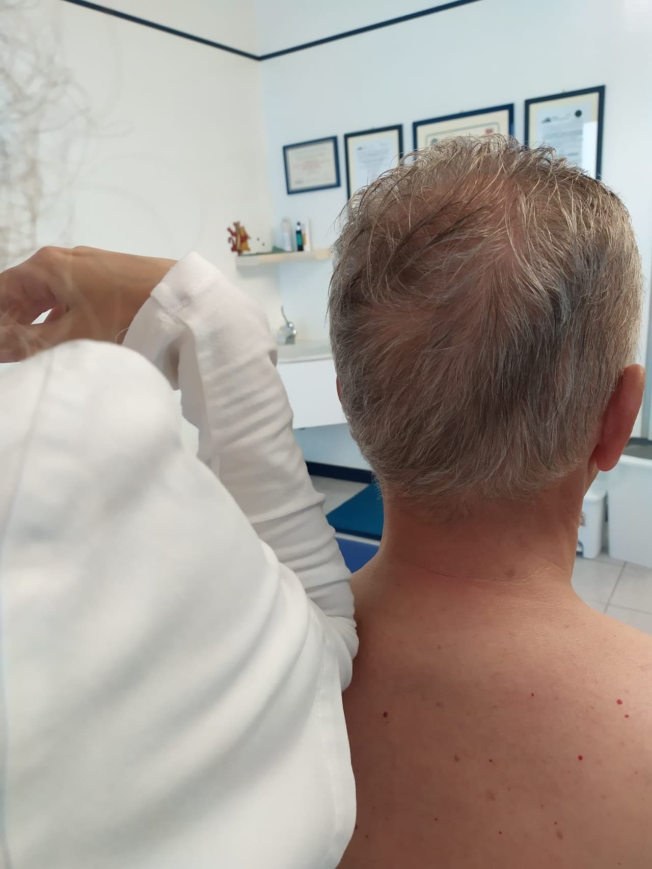 Trattamento trigger point